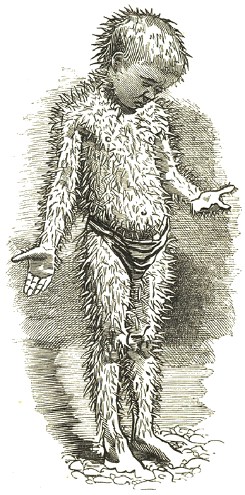 Illustration