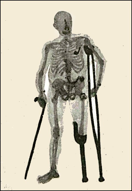 Illustration